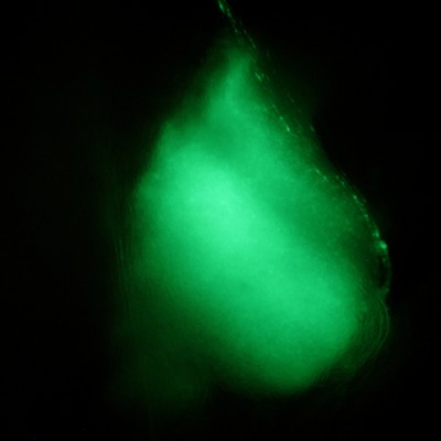 Limb bud electroporated with GFP expression construct, 3.5 days (Matt Schwarz)